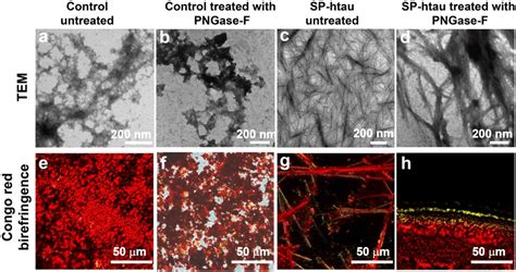 Amyloid fibrils in culture medium containing secreted SP-htau: TEM ...