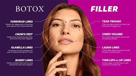 Botox and Filler, What Fits For You?: Outer Banks Dermatology: Board ...