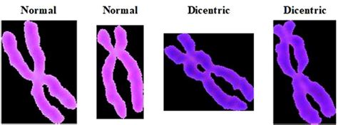 Examples of single chromosome. | Download Scientific Diagram