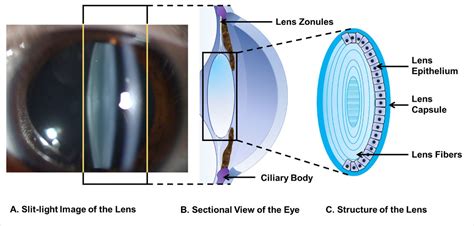 Write the structure of the eye lens and state the role of ciliary ...