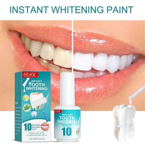 Teeth Whitening: Exactly How It Works, Types, And Negative Effects