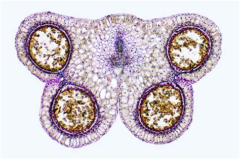 Lily anther, transverse section, showing pollen sacs | Nikon’s Small World