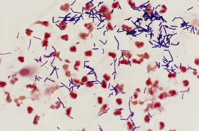 LM of vaginal smear: Lactobacillus acidophilus - Stock Image - M850 ...