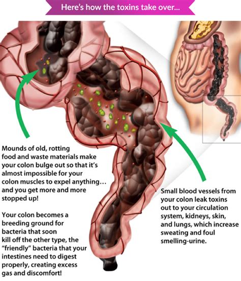 Constipation & Bowel Movement - Functional Health Network Functional ...