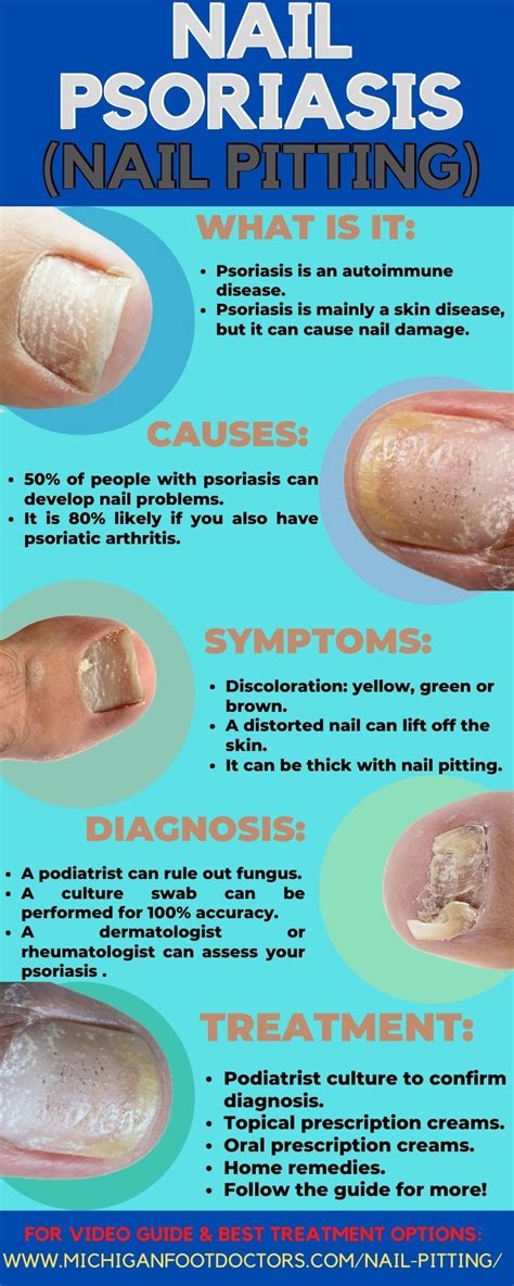 Psoriasis Under The Toenails: [Nail Pits, Causes & Best Treatment]