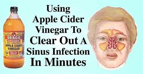 How To Clear Out A Sinus Infection Within Minutes Drinking 2 Tbsp Of ...