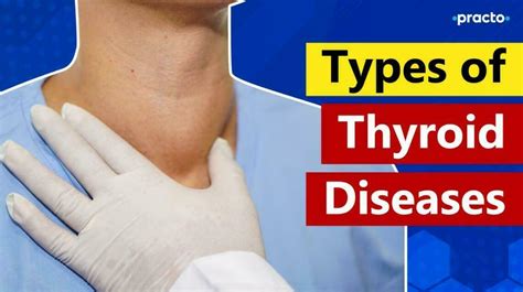 Types of Thyroid Diseases And Their Treatment