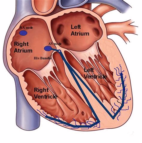 Treatment for Atrioventricular (AV) Block in Washington DC & Maryland