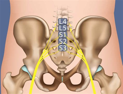 Sciatica Symptoms, Diagnosis & Treatment | Miami Neuroscience Center