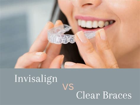 Invisalign vs Clear Braces: Pros and Cons - YouMeMindBody