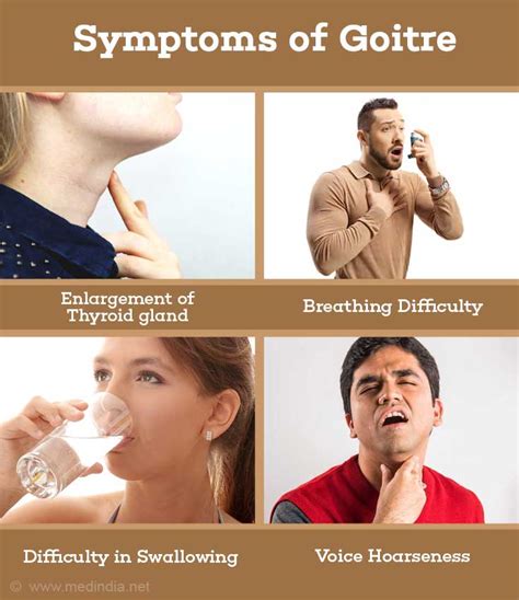 Goitre (Thyroid Swelling) - Types, Causes, Symptoms, Diagnosis ...