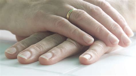 Early detection of cancer: Altered fingernails can indicate lung cancer ...