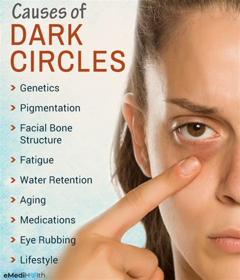 What Causes Dark Under Eyes - Infoupdate.org