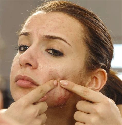 Infected pimple: Symptoms, diagnosis, and treatment