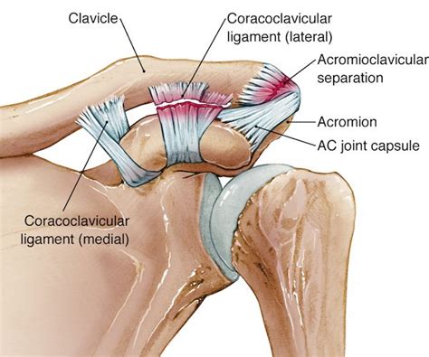 Arthritis and AC Joint Dislocation Surgeries in Bangalore - Dr.Nataraj H M