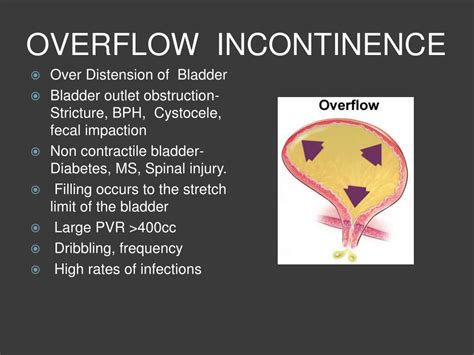 PPT - URINARY INCONTINENCE PowerPoint Presentation, free download - ID ...