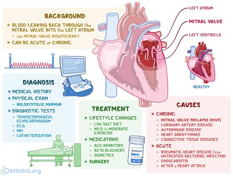 Mitral Valve Regurgitation: What Is It, Causes | Osmosis