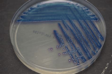 Chromogenic agar – CMP