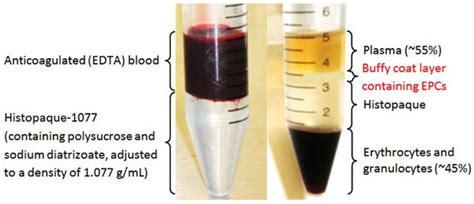 What is Buffy Coat : Uses, How to collect, Test and Alternatives