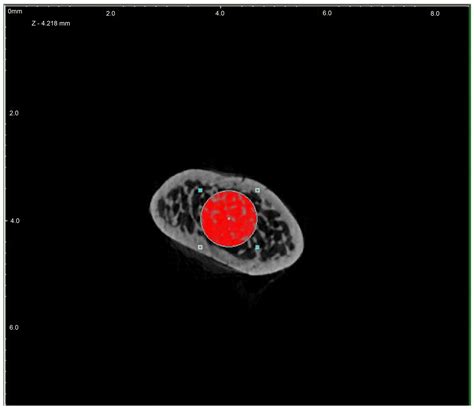 Nutrients | Free Full-Text | Strontium Ranelate and Strontium Chloride ...