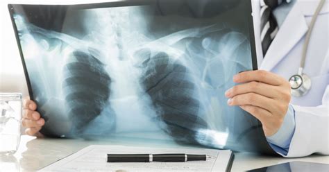 Chest Imaging - What Your Chest Scan Can Reveal | Touchstone Imaging ...