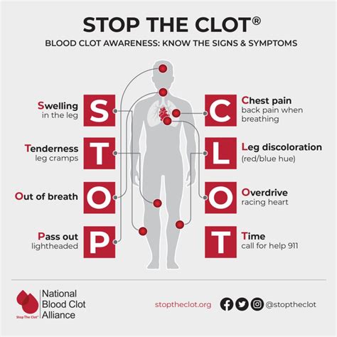 Signs and Symptoms of Blood Clots