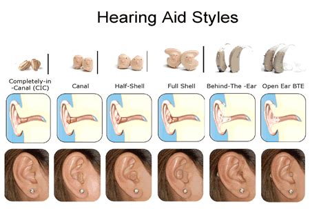 What is the difference between the available types of hearing aids ...