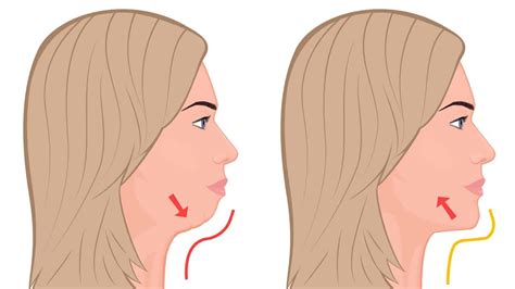 How To Edit Double Chin In Pictures - the meta pictures