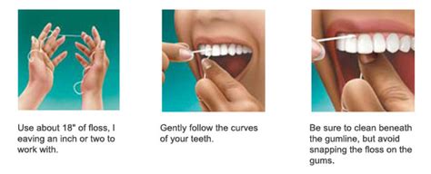 Prevent Future Dental Problems | Smile-LA.com