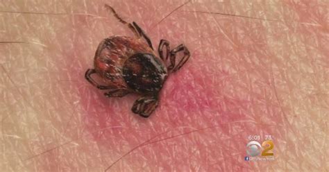 Gulf Coast Tick, Native To Southeastern US, Found In Suburban Chicago ...