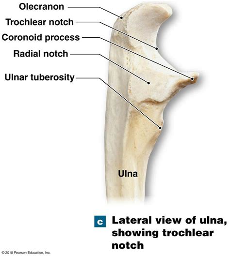 laterial view of ulna showing trochlear notch | Medical anatomy, Human ...