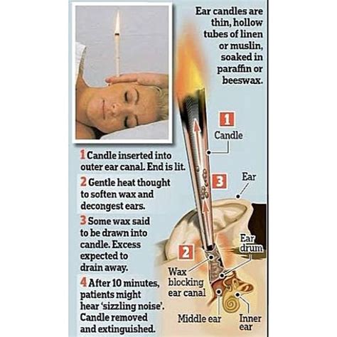 Where To Get Ear Wax Candle - Image ... #EarWaxBlockage | Ear candling ...