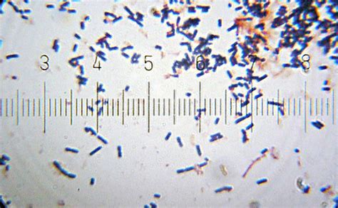 Lactobacillus acidophilus - microbewiki