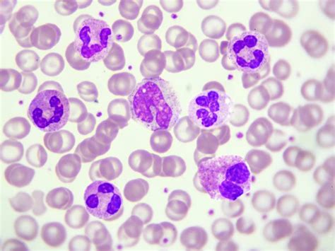 What Are Leukocytes? Types of Leukocytes