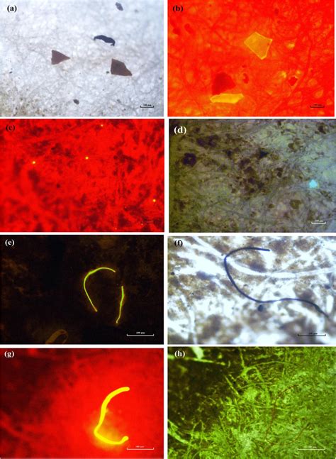 /*/Microscopic images of microplastic particles (a, b, c, d) and ...