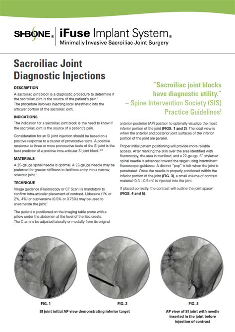 SI Joint Diagnosis - History and Patient Presentation | SI-BONE