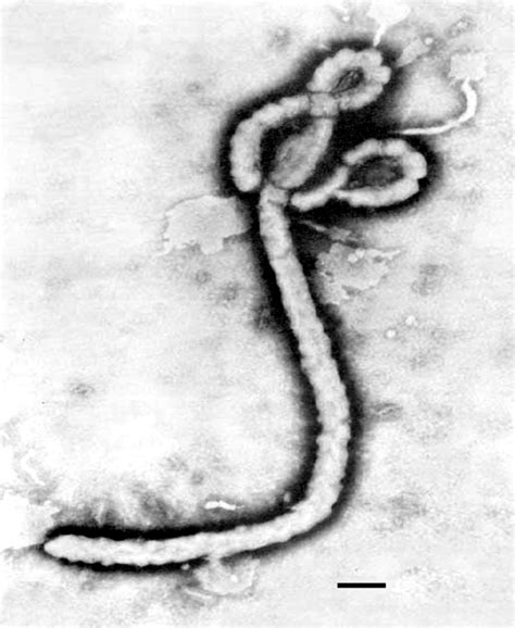 Ebola Virus Under Microscope