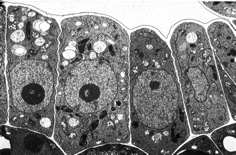 Label Electron Micrograph Plant Cells