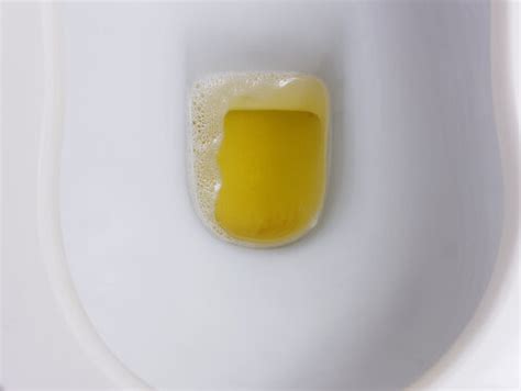 Pictures Of Bubbles In Urine - Go-images Web