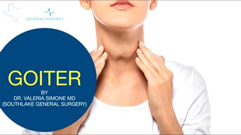 Goiter – Causes, Symptoms, Treatment, and Surgery - YouTube