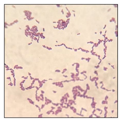 Gram stain results of Lactobacillus spp. from (a) Bear Brand, (b) Nido ...