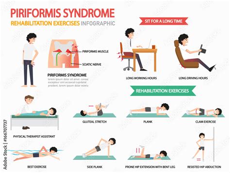 piriformis syndrome rehabilitation exercises infographic, illustration ...