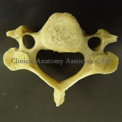 Cervical Vertebrae Transverse Foramen