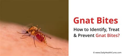 Gnat Bites: How to Identify and Treat Them? | Daily Health Cures