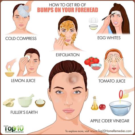 How to Get Rid of Bumps on Forehead | Top 10 Home Remedies # ...