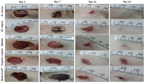 Aspect and photographical representation of burn healing process and ...