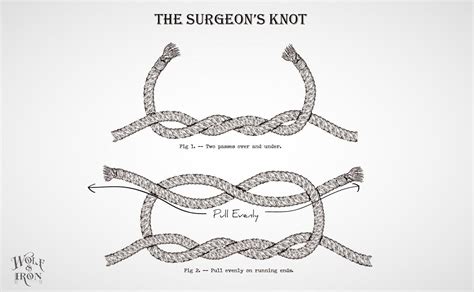 How to Tie a Surgeon’s Knot – Wolf & Iron