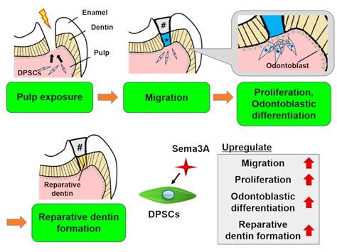 DPSCs in Regenerative Therapy | Encyclopedia MDPI