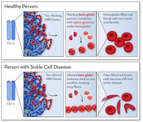 Examples of Single Gene Disorders