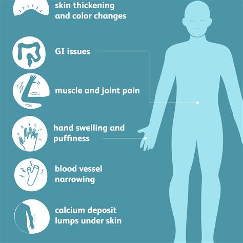 Scleroderma: Signs, Symptoms, and Complications